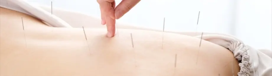 コンセプト鍼イメージ